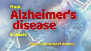 What causes Alzheimers Disease   Types of Alzheimers Disease