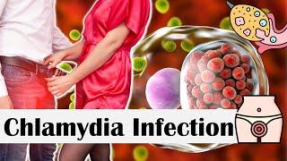 Chlamydia Infection - Causes Risk Factors Transmission Signs & Symptoms Diagnosis & Treatment