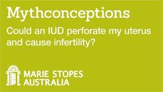 Could an IUD perforate my uterus and cause infertility?