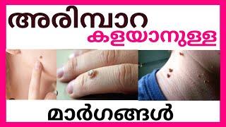 അരിമ്പാറ കളയാനുള്ള മാർഗങ്ങൾ  HUMAN PAPILOMA VIRUS