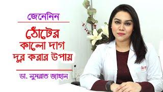 ঠোঁটের কালো দাগ দূর করার সহজ উপায়  Beauty Tips lip Care Bangla  Dr.Nusrat Jahan  Doctor Tube