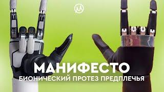 Бионический протез предплечья Manifesto Hand подвижность каждого пальца