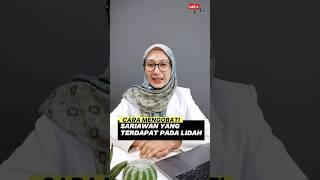 CARA MENGOBATI SARIAWAN DI LIDAH #sariawan #obatsariawan