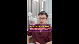 Viêm lợi do gắn khâu nguyên nhân do đâu?