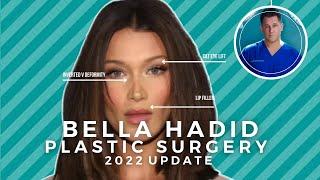 Bella Hadid UPDATE Plastic Surgeon Reacts to Bella admitting to nose job LYING about eye lift?