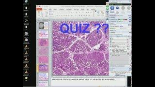 Medical School Pathology 2012 Session 064 Female Genital Tract III and Breast.mp4