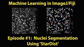 Machine Learning in ImageJFiji - StarDist