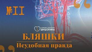 Бляшки и как с ними жить  доктор  Шишонин встретился с сосудистым хирургом – А. А. Шубиным