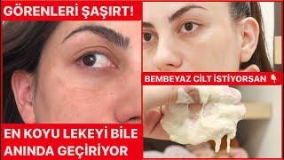 ANINDA RENK AÇILIYOR LEKESİZ BEMBEYAZ CİLT BÖYLE OLUYOR  GÖREN GEÇMEZ BU DERSE İNANMA HEMEN YAP