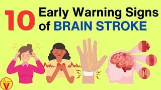 10 Warning Signs of Stroke One Month Before It Happens  VisitJoy