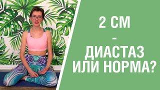 Вся правда про диастаз после родов. Что такое диастаз и как его определить?