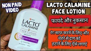 Lacto Calamine Face Lotion लैक्टो कैलामाइन लोशन  How to use lacto calamine lotion Review In Hindi