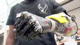 B.C. teams bionic hand going to Cyborg Olympics