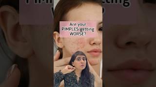 Acne Treatment  Pimple Removal  Acne  Acne Removal #shorts