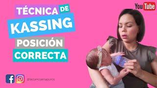 Técnica Kassing posición correcta