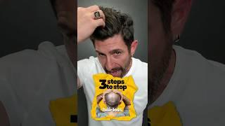 3 Steps to STOP Hair Loss Forever