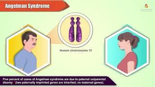 Angelman Syndrome  Pathology and Genetics