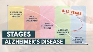 Stages and Life Expectancy of Alzheimers Disease
