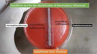 Satellitism Test for Identification of Haemophilus influenzae Satellitism Test Positive