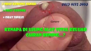 Penyebab kencing sakit keluar nanah pada ujung penis alat vital pria