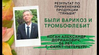 Результат по применению продукции Тяньши. Был варикоз и тромбофлебит. Коган Александр Дорианович.