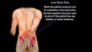 Low Back Pain - Disc Herniation which type is concerning.