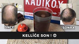 KELLİĞE SON  