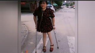 The beautiful woman with polio walks on crutches #polio_woman