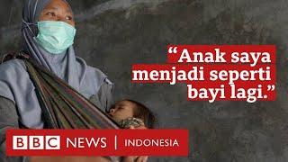 Gagal ginjal akut Anak masih harus terus cuci darah orang tua cari keadilan - BBC News Indonesia