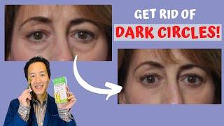 How Do I Get Rid of Under-Eye Circles Without Surgery? - Dr. Anthony Youn