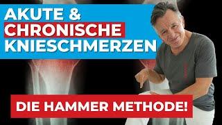 Akute & chronische Knieschmerzen - Die Hammer Methode