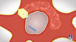 microRNA-based silencing of an ALS gene safely delivered to patients