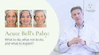 Acute Bells palsy What to do What NOT to do and What to expect