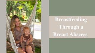 Breastfeeding Through a Breast Abscess The Story of How one Woman Continued to Breastfeed