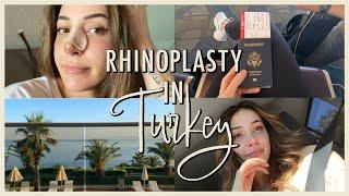 Rhinoplasty in Turkey  USA Patient  Dr. Muhammet Dilber