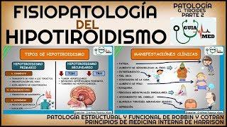 HIPOTIROIDISMO FISIOPATOLOGÍA  GuiaMed