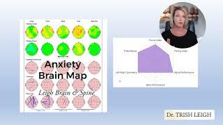 What Does an Anxiety Brain Map Look Like? wDr. Trish Leigh