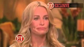 Taylor Armstrong The Physical Signs of Abuse