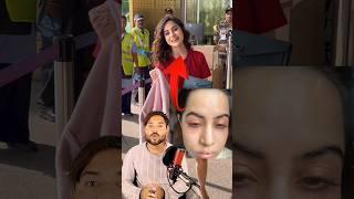 Urfi Javed Surgery Viral Photos  Urfi Javed New Look Viral Video  MG #shorts #urfijaved