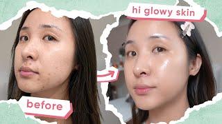 Affordable Korean Skincare Routine for ACNE + MUST-TRY TIPS 