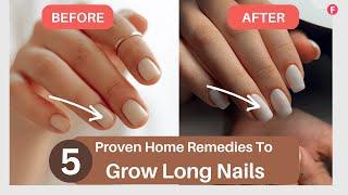 5 Most Effective Home Remedies To Grow Long Nails