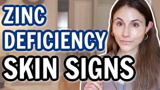 Skin SIGNS OF ZINC DEFICIENCY @DrDrayzday