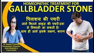 Gallstones Best treatment without surgeryपित्ते की पथरी को होम्योपैथिक ईलाज