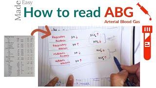 How to check ABG or arterial blood gas  ABG Interpretation