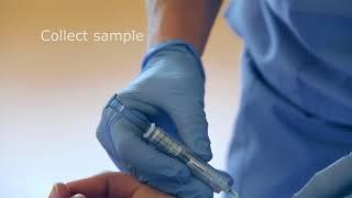 Arterial puncture sampling to obtain an arterial blood gas