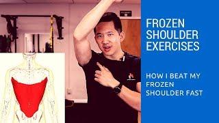Frozen shoulder exercises - how I got relief in just two days