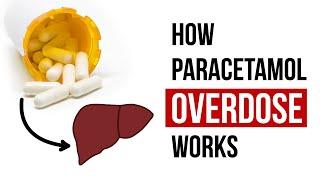 How Paracetamol Overdose Works
