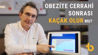 Obezite cerrahisi sonrası kaçak olur mu?