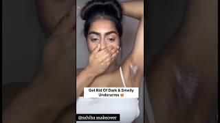 Get Rid Of Dark & Smelly UnderarmsDarkness Remove Hometips ll #beatytips #skincare #ytshorts #viral