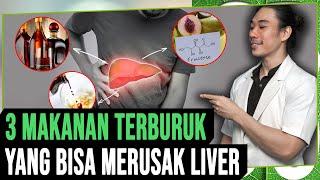 3 MAKANAN TERBURUK YANG BISA MERUSAK LIVER